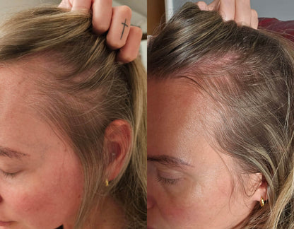 Crown &amp; Bloom™ - سيروم نباتي لنمو الشعر يحفز بصيلات الشعر ويمنع هرمون DHT