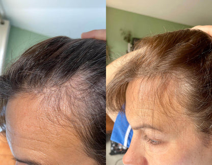 Crown &amp; Bloom™ - سيروم نباتي لنمو الشعر يحفز بصيلات الشعر ويمنع هرمون DHT