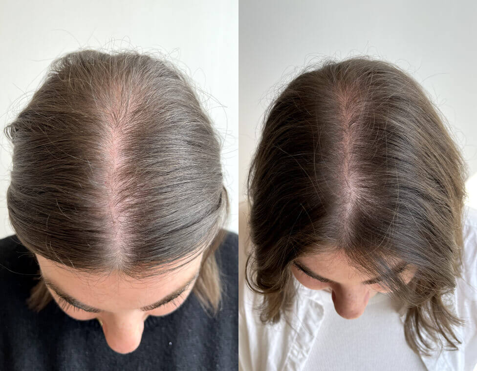 Crown & Bloom™ - Follicle Stimulating + DHT Blocking Botanical Hair Growth Serum