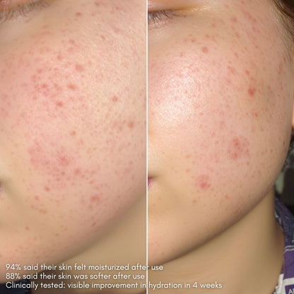 Glow 49% Jojoba Oil Serum